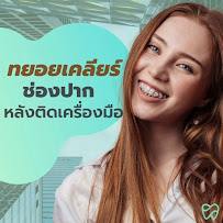 คลินิก เปปเปอร์มินต์ จัดฟัน ราคาถูก จัดฟันใส ฟอกสีฟัน จัดฟันเด็ก วีเนียร์ อุดมสุข บางนา พระโขนง