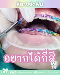 คลินิก เปปเปอร์มินต์ จัดฟัน ราคาถูก จัดฟันใส ฟอกสีฟัน จัดฟันเด็ก วีเนียร์ อุดมสุข บางนา พระโขนง