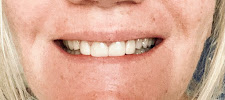 Nana Dental Clinic คลินิกทันตกรรมนานา