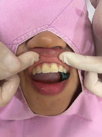 Dentalista at Phrompong