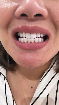 Grace Dental Clinic Bang Ka-Pi
