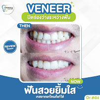 Deezy dental home โชคชัย4 | ทำฟัน จัดฟัน วีเนียร์ รากฟันเทียม