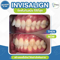 Deezy dental home โชคชัย4 | ทำฟัน จัดฟัน วีเนียร์ รากฟันเทียม