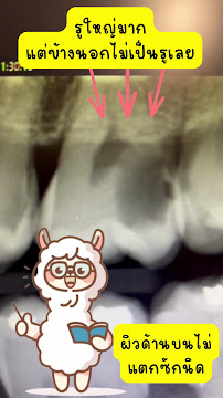 คลินิกทันตกรรมอัลปาก้า(นนทบุรี) จัดฟัน ทำฟัน เด็ก-ผู้ใหญ่ Alpaca Dental Clinic (Nonthaburi)