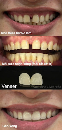 Nha Khoa Thẩm Mỹ Bác Sĩ Diệu Hiền