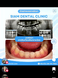 Siam Dental Clinic