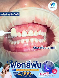 CLASS Dental Clinic - ศรีนครินทร์ ทำฟัน จัดฟัน รับประกันสังคม/บริษัท
