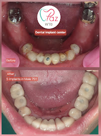 Paz dental clinic คลินิกพาซ
