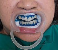 Paz dental clinic คลินิกพาซ
