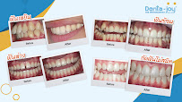 Dentajoy Seacon Square Srinakarin (เดนต้าจอย ซีคอน ศรีนครินทร์) จัดฟันใส Invisalign จัดฟัน Brava วีเนียร์ รากเทียม
