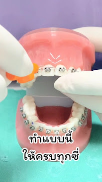 คลินิกฟันยิ้ม ราม2 (จัดฟัน วิเคราะห์ใบหน้า ทำฟัน ฟอกสี ครอบฟัน ราม2 บางนา ครบวงจร)