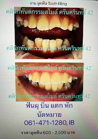 คลินิกทันตกรรมสไมล์ ศรีนครินทร์ Smile Dental Clinic Srinakarin