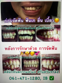 คลินิกทันตกรรมสไมล์ ศรีนครินทร์ Smile Dental Clinic Srinakarin