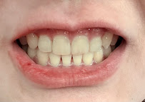 Toothmate Dental Clinic Sathon