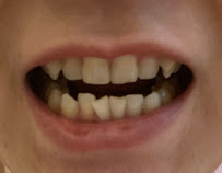Toothmate Dental Clinic Sathon