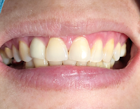 Sanus Dental Clinic Sathorn