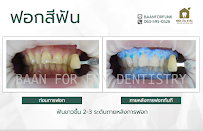 บ้าน ฟ.ฟัน คลินิกทันตกรรม (Baan For Fun)