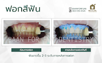 บ้าน ฟ.ฟัน คลินิกทันตกรรม (Baan For Fun)