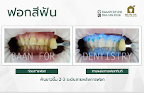 บ้าน ฟ.ฟัน คลินิกทันตกรรม (Baan For Fun)