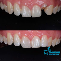 Gemini Dental Care