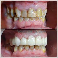 Your Dental Care