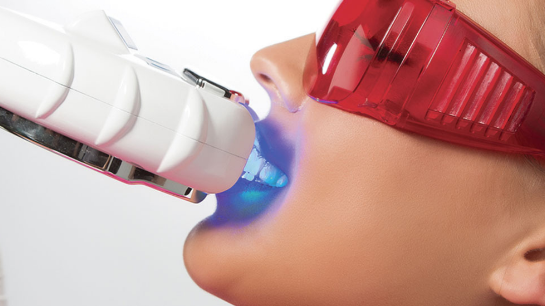 The Teeth Whitener Bali dental clinic