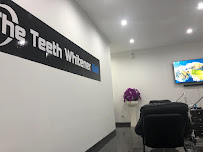 The Teeth Whitener Bali