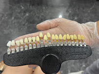The Teeth Whitener Bali