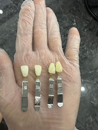 The Teeth Whitener Bali