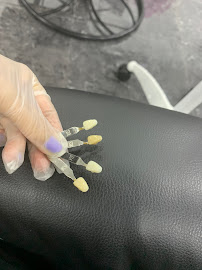 The Teeth Whitener Bali
