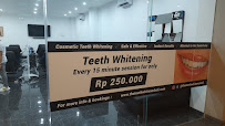 The Teeth Whitener Bali