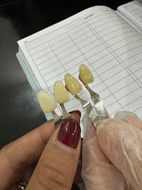 The Teeth Whitener Bali