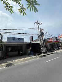 Bali Smile Teeth Whitening Seminyak