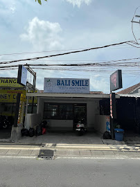 Bali Smile Teeth Whitening Seminyak
