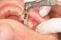 Ubud Dental Center