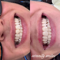 Serenity Smiles Center in Bali