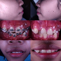 Glimlach Dokter Gigi & Implan Denpasar - drg. Wirya Pratama, MMRS