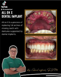 drg. Asnul Arfani, Sp.BM (Oral Maxillofacial Surgeon & Implantologist)