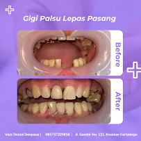 Vozz Dental Denpasar | Dokter Gigi Denpasar
