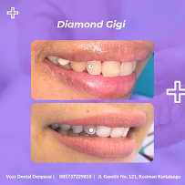 Vozz Dental Denpasar | Dokter Gigi Denpasar