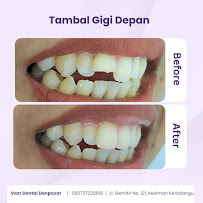 Vozz Dental Denpasar | Dokter Gigi Denpasar