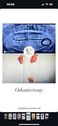 drg. Made Merta Suparka, Sp.BMM,I.D.M.(K),FISID. (Oral Maxillofacial Surgeon & Implantologist)