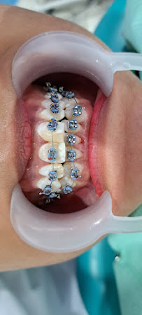 Vozz Dental | Dokter Gigi Gianyar