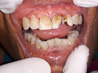 Vozz Dental | Dokter Gigi Gianyar