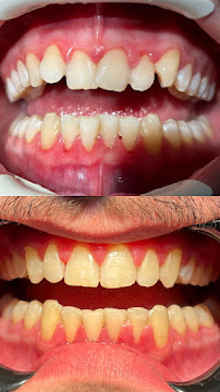 Modern Dental მოდერნ დენტალი