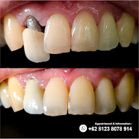 INDOSMILE DENTAL CARE