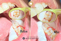 INDOSMILE DENTAL CARE