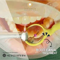 INDOSMILE DENTAL CARE