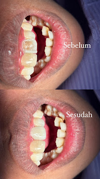 PRAKTEK DOKTER GIGI (DENTIST) drg. Desak G.R Adiasih S,kg
