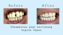 PRAKTEK DOKTER GIGI (DENTIST) drg. Desak G.R Adiasih S,kg